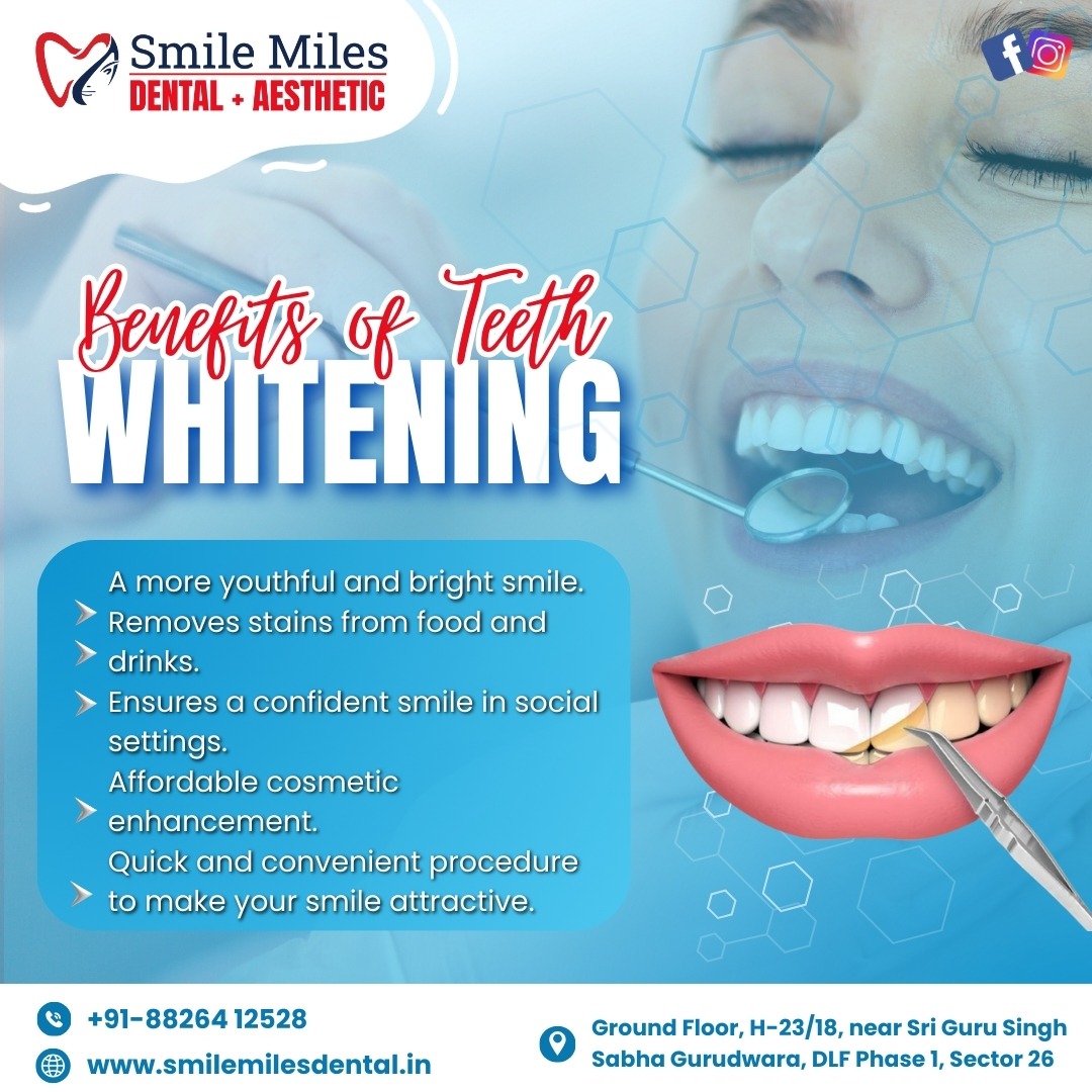 Teeth Whitening Treatment